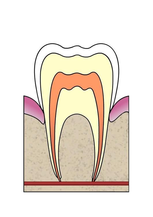 Evolución de caries