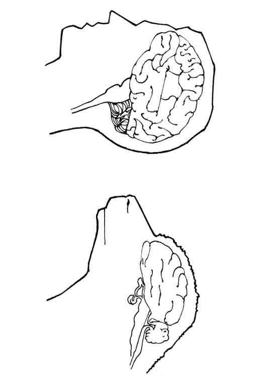 cerebro de humano y cerebro de oveja