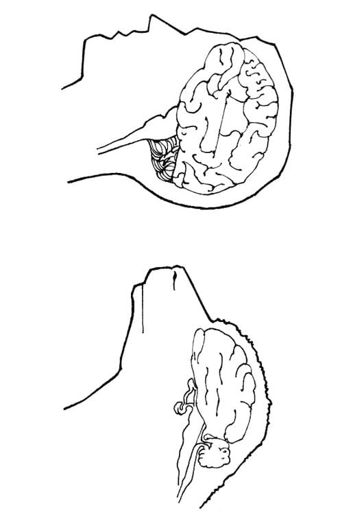 cerebro de humano y oveja
