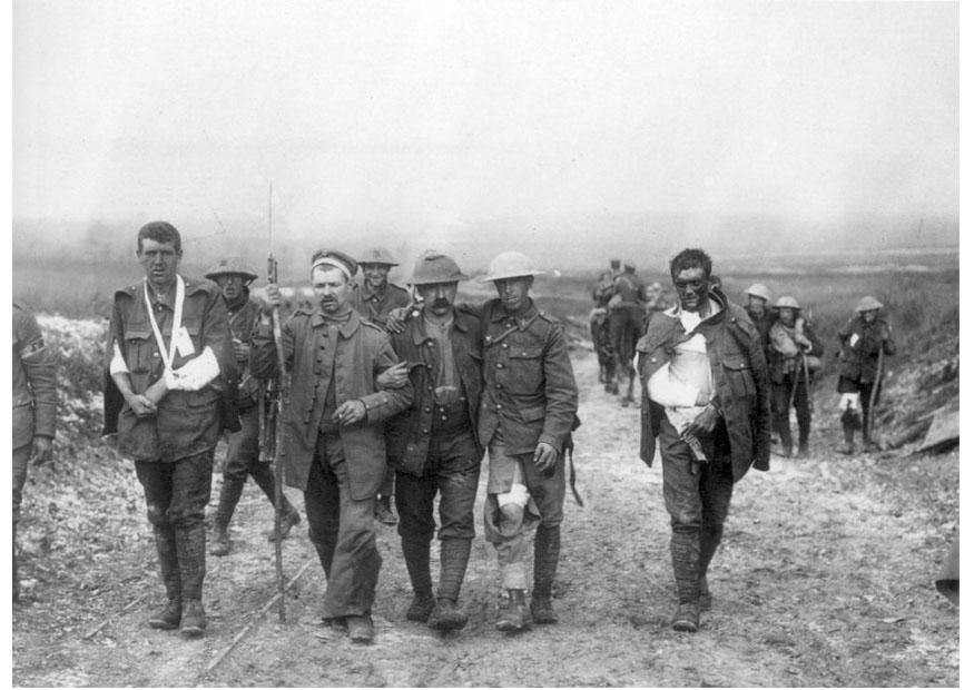 Foto Soldados britÃ¡nicos heridos
