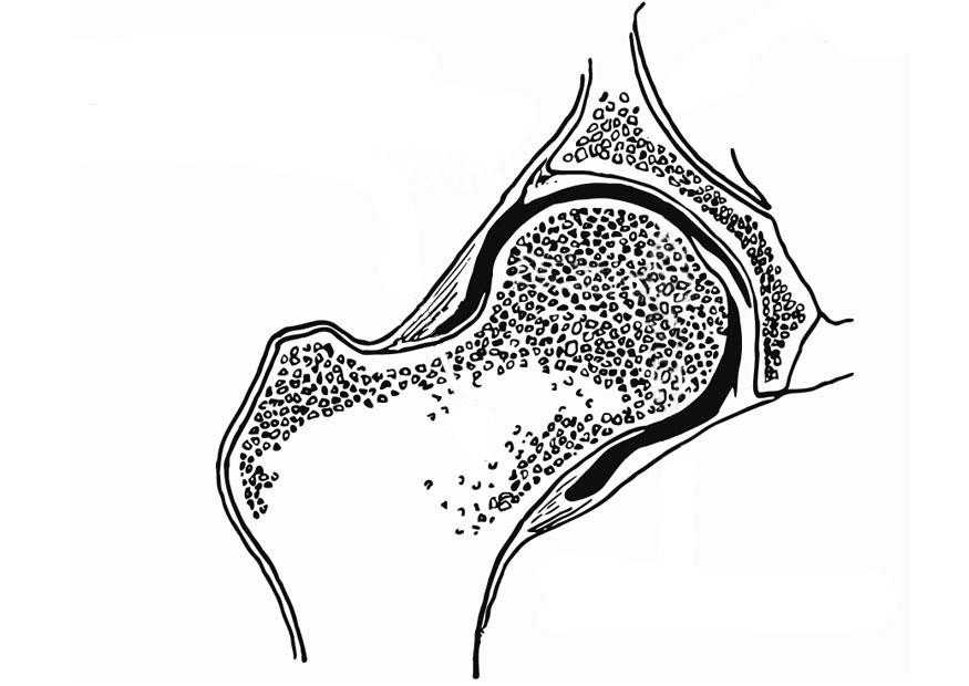 Dibujo para colorear articulaciA³n coxofemoral