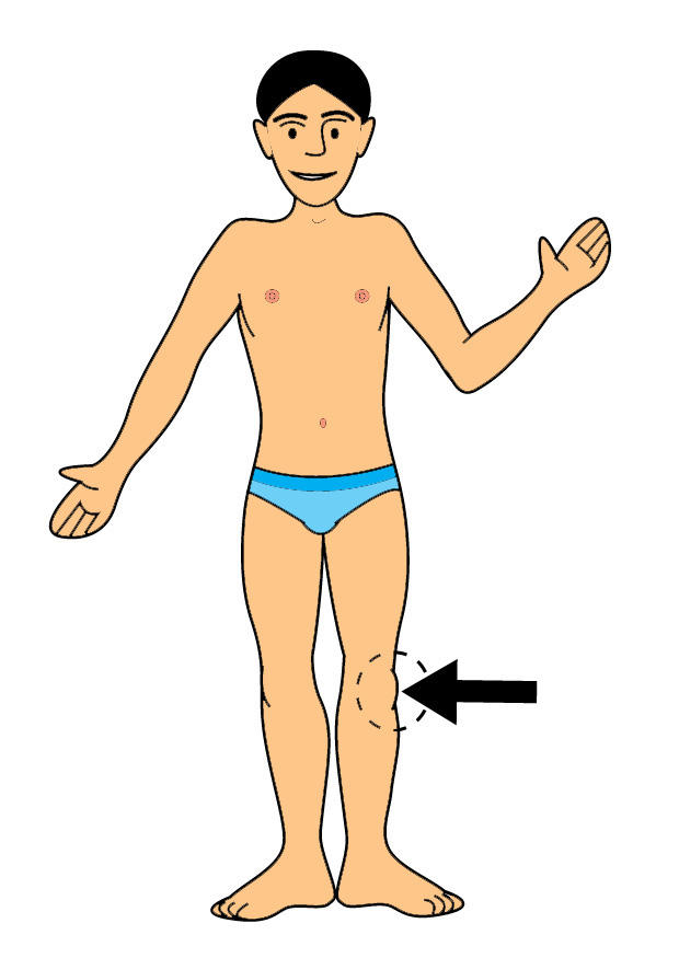 rodilla Imagen rodilla